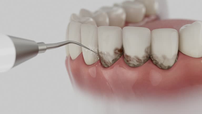 Trusted Tooth Extraction service in Hillsborough, CA - Dentist Open Now